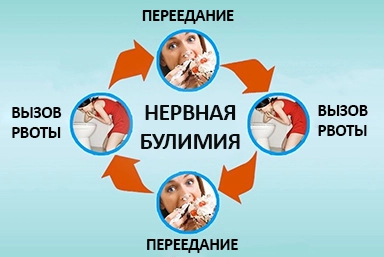 Лечение булимии в Архаре